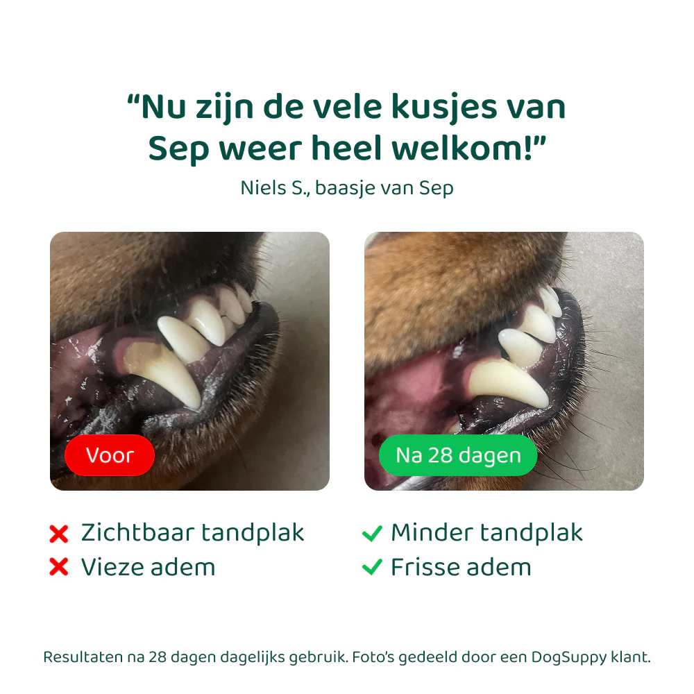Dental Bright 🌿 60 schepjes - Image 8
